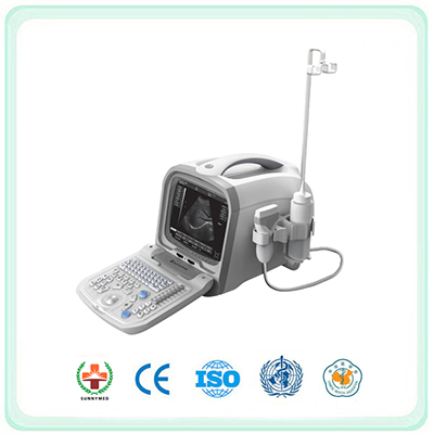 S6601 Portable Full Digital Ultrasound System